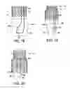 Fig. 08 - Anti-Aspiration Prosthesis