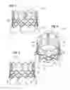 Fig. 02 - Prosthetic heart valve