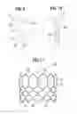 Fig. 04 - Prosthetic heart valve