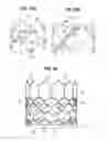 Fig. 07 - Prosthetic heart valve