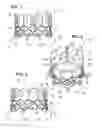 Fig. 02 - Prosthetic heart valve