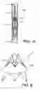 Fig. 04 - Percutaneous heart valve prosthesis