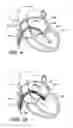 Fig. 07 - Percutaneous heart valve prosthesis