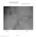 Fig. 22 - Percutaneously Deliverable Heart Valve and Methods Associated Therewith