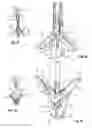 Fig. 09 - Delivery catheter handle and methods of use