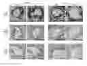 Fig. 01 - COMPOSITIONS AND METHODS FOR THE TREATMENT OF PULMONARY ARTERIAL HYPERTENSION