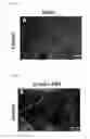 Fig. 06 - METHOD OF TREATING, REDUCING, PREVENTING DETERIORATION OR IMPROVING VISUAL FUNCTION AFTER OPTIC NEUROPATHY