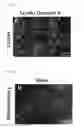 Fig. 07 - METHOD OF TREATING, REDUCING, PREVENTING DETERIORATION OR IMPROVING VISUAL FUNCTION AFTER OPTIC NEUROPATHY