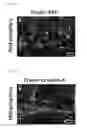 Fig. 08 - METHOD OF TREATING, REDUCING, PREVENTING DETERIORATION OR IMPROVING VISUAL FUNCTION AFTER OPTIC NEUROPATHY
