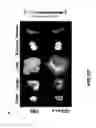 Fig. 131 - Compositions and methods for treating cardiac injury