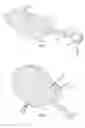 Fig. 02 - Vacuum Wound Device