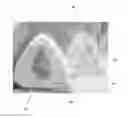 Fig. 01 - CPAP mask cushion cover