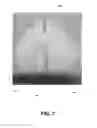 Fig. 08 - CPAP mask cushion cover