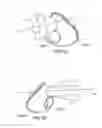 Fig. 07 - A VENT FOR A COMPONENT OF A  RESPIRATORY THERAPY SYSTEM