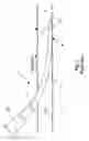 Fig. 02 - IMPROVED CATHETER