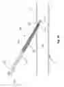 Fig. 09 - IMPROVED CATHETER