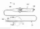 Fig. 01 - Lumen management catheter
