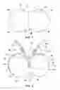 Fig. 02 - Catheter Securement Device With At Least One Vertical Slit