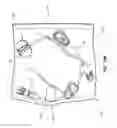 Fig. 20 - Safety Needle Set For Delivering Fluid To An Access Port