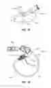 Fig. 33 - Safety Needle Set For Delivering Fluid To An Access Port