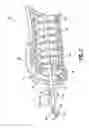 Fig. 06 - Catheter assembly