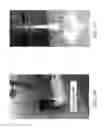 Fig. 35 - Systems and methods for anti-microbial effect for bones