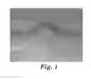 Fig. 02 - Method of making structured hybrid adhesive articles including lightning strike protection sheets