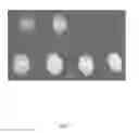 Fig. 08 - High density fast phosphor for electron microscopy