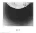 Fig. 06 - Polymeric nanofibers and nanofibrous web