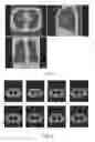 Fig. 03 - Medical image display method and imaging apparatus