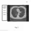 Fig. 05 - Medical image display method and imaging apparatus