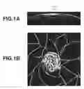 Fig. 02 - Apparatus, method, and medium for reducing pixel values in unnecessary regions in medical images