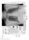 Fig. 22 - Systems and methods to deliver point of care alerts for radiological findings