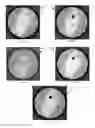 Fig. 04 - Training a CNN with pseudo ground truth for CT artifact reduction
