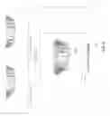 Fig. 07 - Technologies for merging three-dimensional models of dental impressions