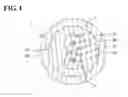 Fig. 02 - Cable