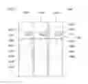 Fig. 09 - Transport container automatic clamping mechanism