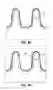 Fig. 08 - Differentiated voltage threshold metal gate structures for advanced integrated circuit structure fabrication