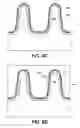 Fig. 08 - Trench contact structures for advanced integrated circuit structure fabrication