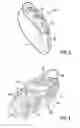 Fig. 03 - Implantable electronic medical device and transmit/receive antenna therefor