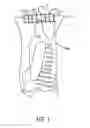 Fig. 02 - Meat processing devices to control meat slab dimensions