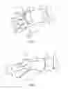 Fig. 02 - Illuminated glove