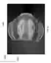 Fig. 35 - Helmet padding system