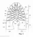 Fig. 06 - Expandable support member for an article of footwear