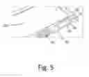 Fig. 06 - Electronic Device Protector