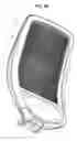 Fig. 50 - Compliant backrest