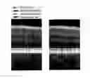 Fig. 01 - Systems and methods to remove shadowgraphic flow projections on OCT angiography