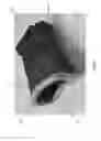 Fig. 03 - METHOD AND SYSTEM FOR PROCESSING AN IMAGE OF THE TEETH AND GUMS
