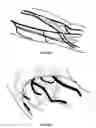 Fig. 07 - Systems And Methods For Visualizing Anatomy, Locating Medical Devices, Or Placing Medical Devices