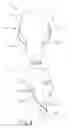 Fig. 10 - SYSTEM AND METHOD FOR TRACKING PATIENT MOVEMENT DURING GUIDED MEDICAL PROCEDURE